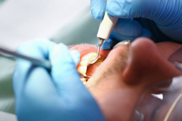 Best Pediatric Emergency Dentist in Boyes Hot Springs, CA