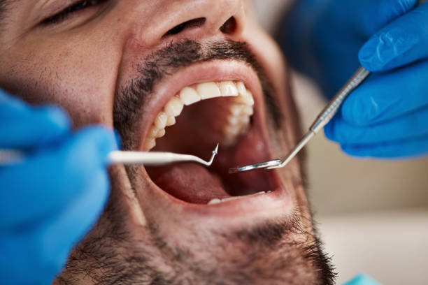 Best Emergency TMJ Treatment in Boyes Hot Springs, CA